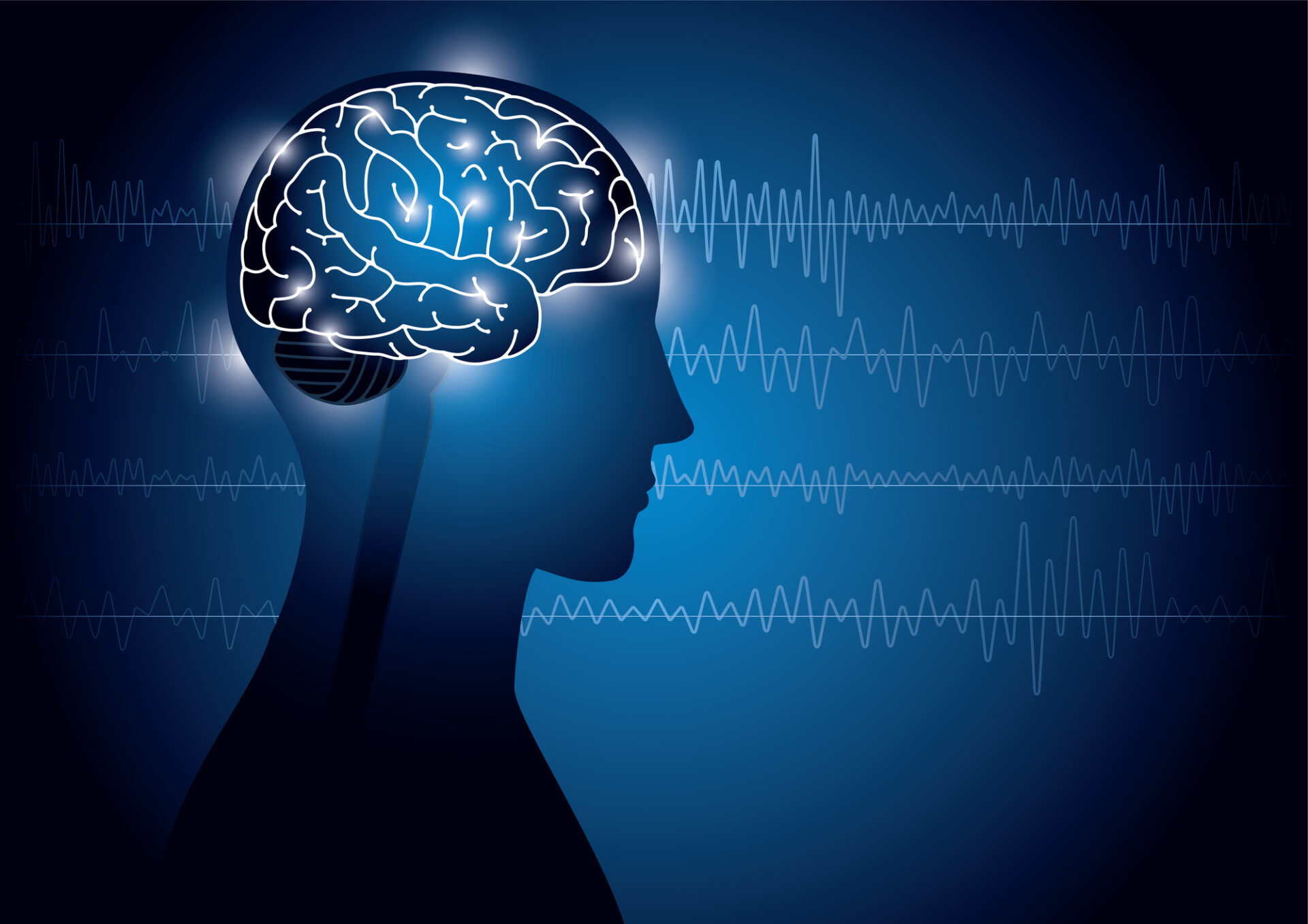 BCI, ブレイン・コンピュータ・インターフェイシング, ロックイン症候群, コミュニケーション, 脳内インプラント, 思考型コミュニケーション